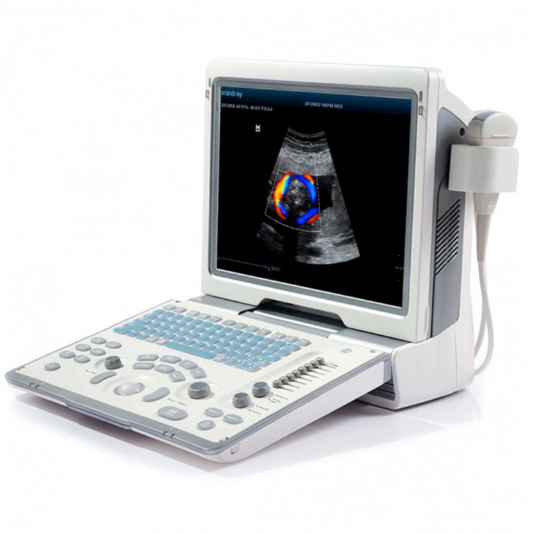 УЗИ аппарат Mindray DP-50 color